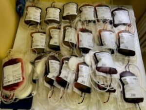 Nemocnica Agel Zlaté Moravce bude odbery krvi organizovať dvakrát mesačne